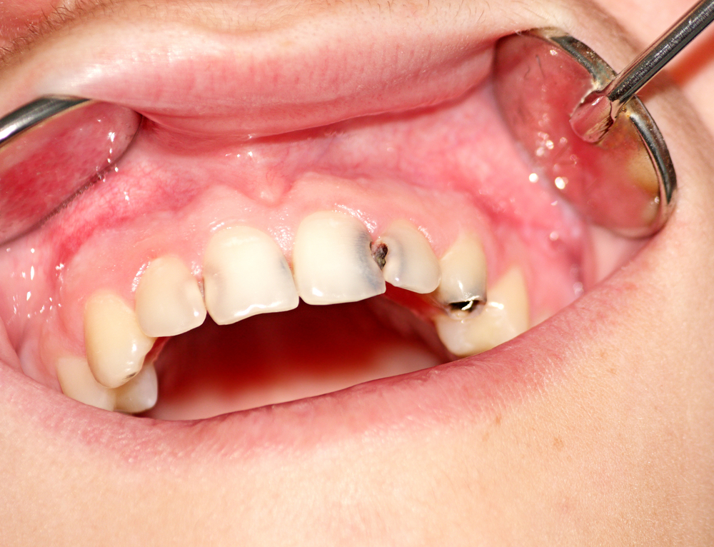 examples of Dental Negligence to look for