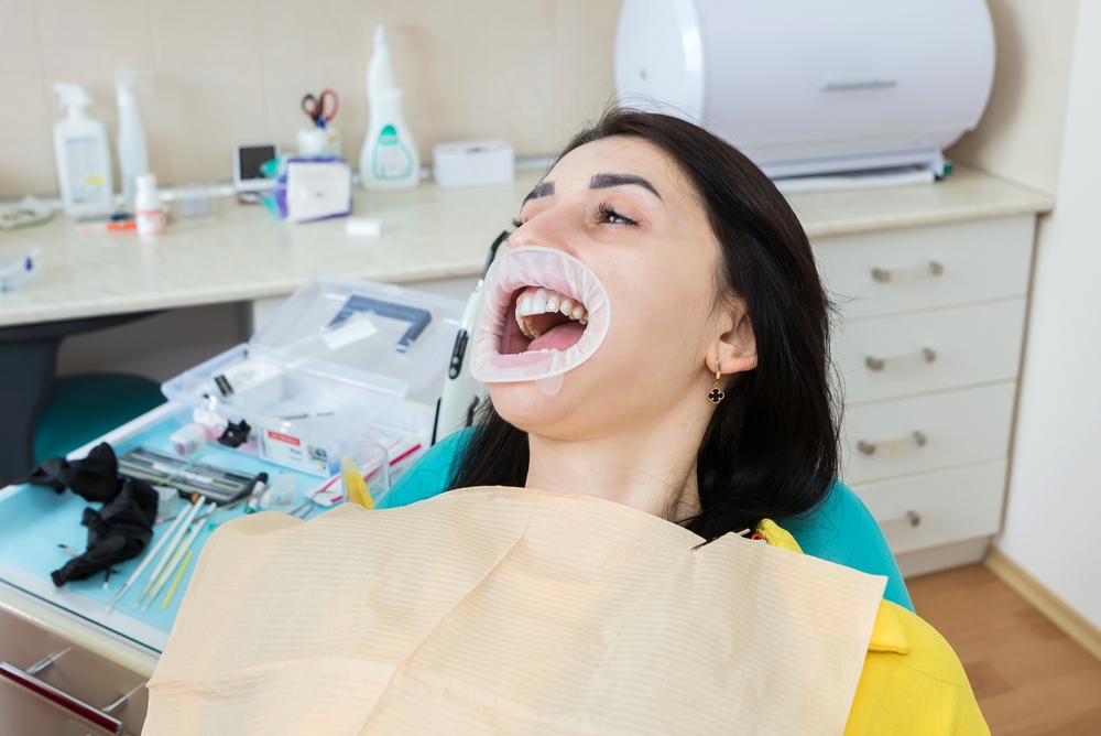 woman getting veneers