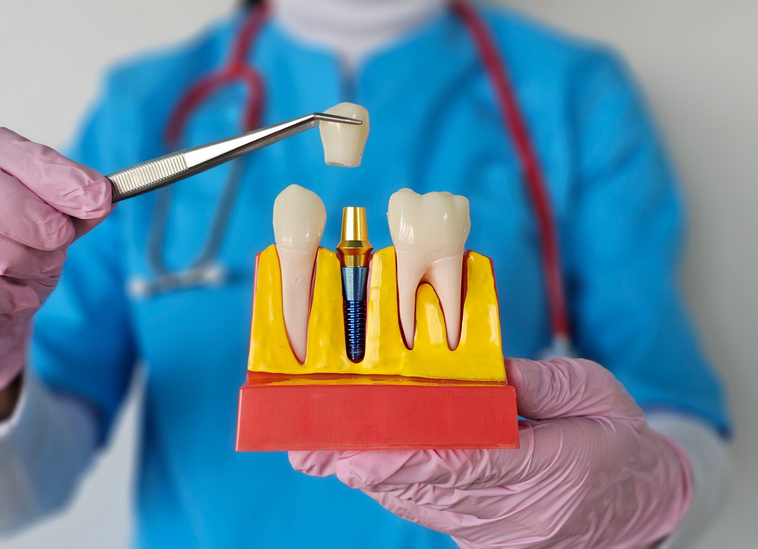 Dentist holding up a model of teeth with a dental implant.