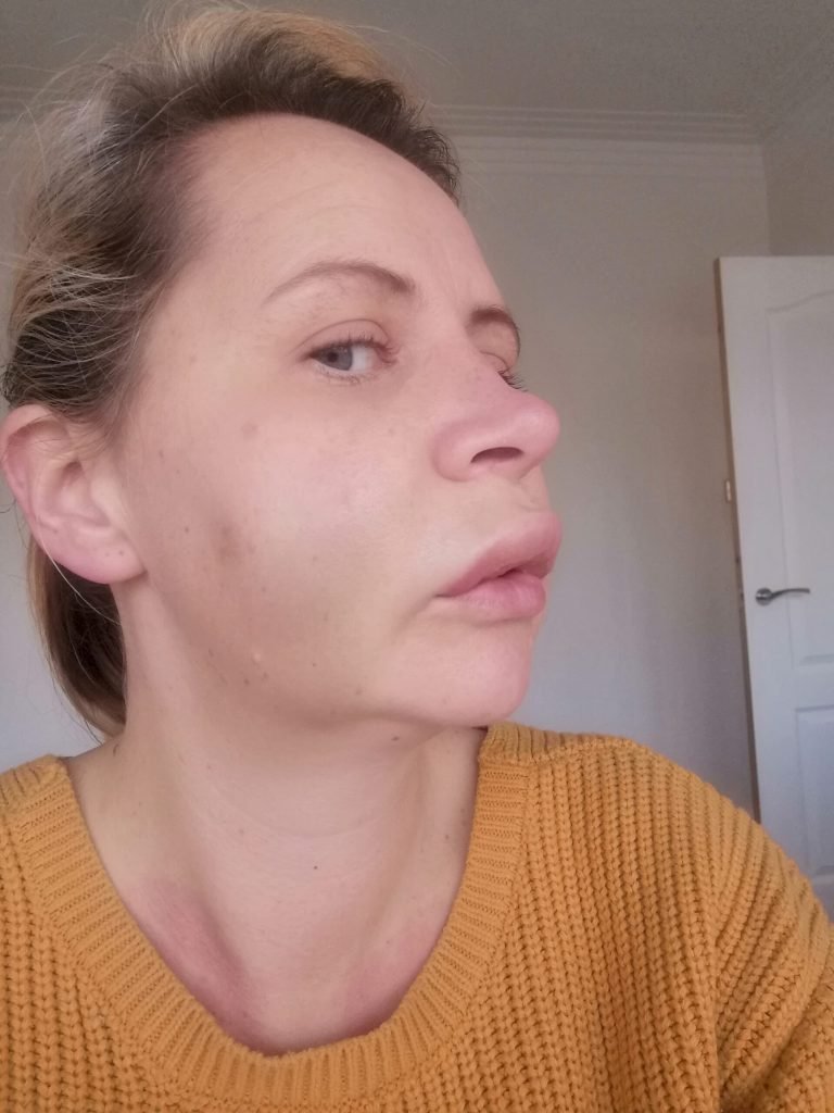 PRESTON WOMAN AWARDED £14,500 AFTER DENTAL ‘NIGHTMARE’ LEFT HER DISFIGURED
