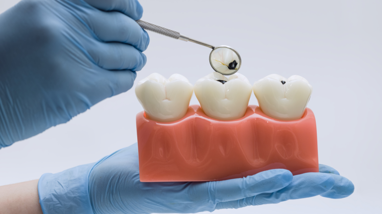 Dental cleaning demonstration
