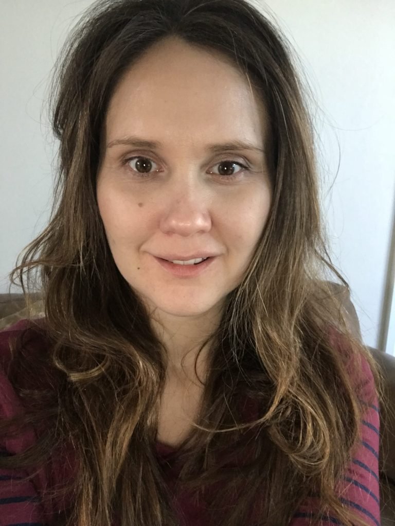 Young Mother Loses Tooth After Botched Treatment By Local Dentist