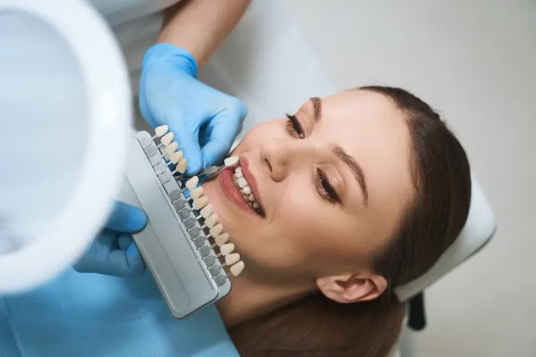 Dental Procedure Guide: Veneers
