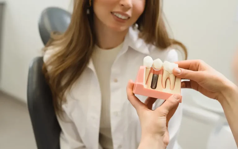 Dental Procedure Guide: Dental Implants
