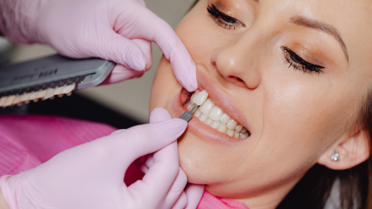 Failed Veneers? You May Be Eligible to Begin a Dental Negligence Claim