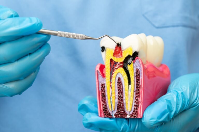 A dentist in scrubs and blue gloves, holds a model of a tooth and uses a tool to demonstrate what can go wrong with a root canal